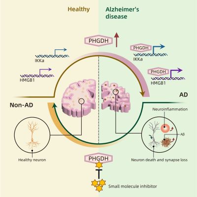graphic showing how Alzheimer's severity increases with PHGDH expression